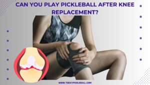 Can You Play Pickleball After Knee Replacement? (Step By Step Guide)